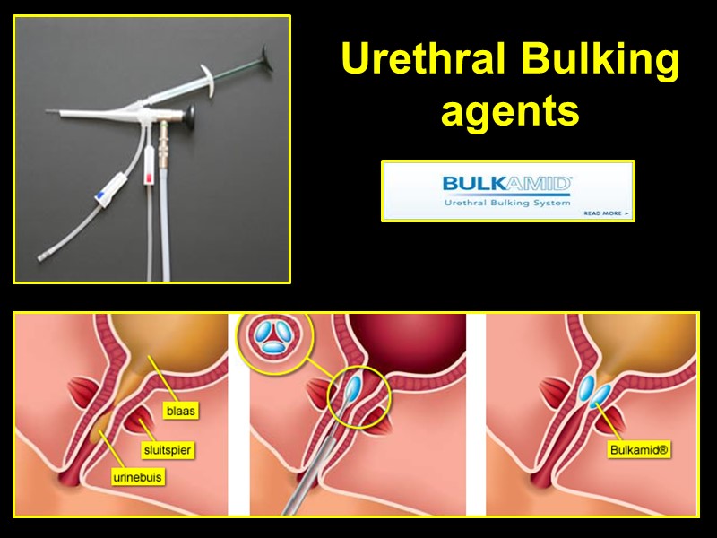 Urethral Bulking agents